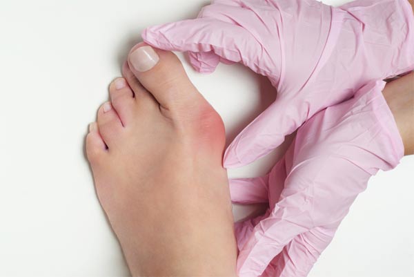 Causes of the foot deformities